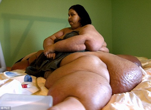 LA DONNA PIU' GRASSA DEL MONDO, HA PERSO 300 KG - ECCO IL VIDEO DI COM'E' OGGI - 22/11/2013