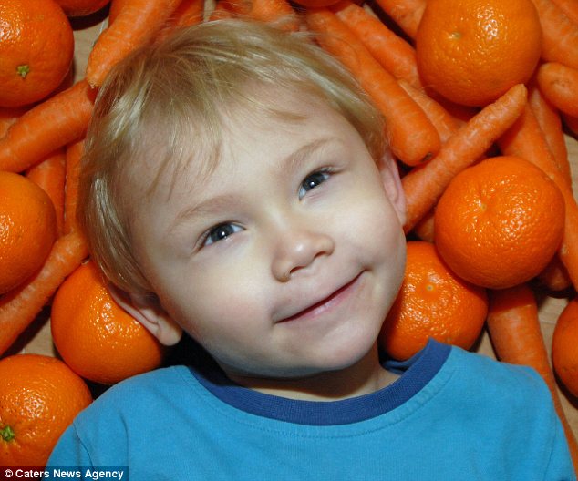 Bimbo di 4 anni diventa arancione se mangia - 19/06/2012