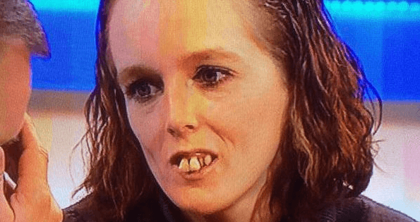 GEMMA ERA LA DONNA PIU BRUTTA DEL MONDO ECCO LA SUA INCREDIBILE 