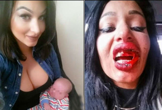MODELLA INCINTA AGGREDITA IN STRADA INSIEME AL SUO PRIMOGENITO: IL BIMBO E' GRAVISSIMO - 01/12/2015