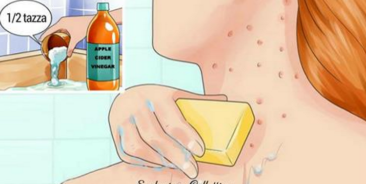 METTETE DELL'ACETO DI VINO SUL VISO E SUL CORPO, QUELLO CHE SUCCEDE DOPO LASCIA SENZA PAROLE - 12/08/2016