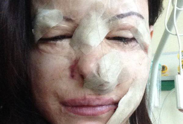 LUCIA ANNIBALDI MOSTRA LE FOTO DELL'INTERVENTO: ''PER NON DIMENTICARE MAI...'' - 01/11/2015