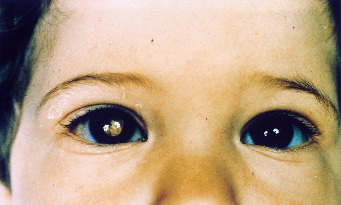 UNA MAMMA SCATTA UNA FOTO AGLI OCCHI DEL FIGLIO E GLI SALVA LA VITA - 14/05/2015