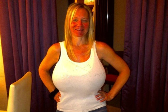 SI FA IMPIANTARE PROTESI AL SENO DA 13 KG, MA QUELLO CHE ACCADE DOPO L'INTERVENTO E' ASSURDO - 01/07/2015