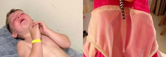 IL PICCOLO JACK, 5 ANNI, E UN ORRIBILE INCIDENTE CON IL COSTUME DA BAGNO: ''HA URLATO FORTISSIMO'' - 24/09/2015