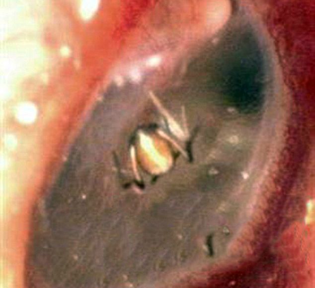 ''GRAFFI E RUMORI, SPIRITI MALIGNI NELL'ORECCHIO'': POI VA IN OSPEDALE E FA UNA SCOPERTA CHOC - 30/09/2015