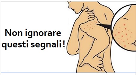ECCO 5 SINTOMI CHE GLI INTOLLERANTI AL GLUTINE SPESSO IGNORANO: MEGLIO FARE ATTENZIONE - 24/01/2017