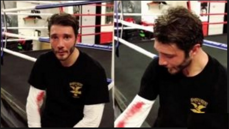 STEFANO DE MARTINO PICCHIATO A SANGUE: PUBBLICA LE FOTO E SPIEGA COS'E' SUCCESSO - 25/01/2017