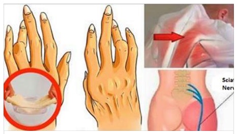 QUESTO SEMPLICE TRUCCHETTO VI AIUTERA' A SCONFIGGERE ARTRITE, SCIATICA E MAL DI SCHIENA: PROVATE E CAPIRETE - 08/02/2017