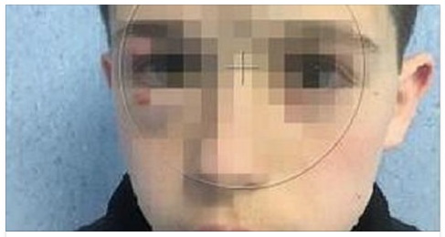 ''GUARDATE COME I BULLI HANNO RIDOTTO MIO FIGLIO FABIO'' IL DURO SFOGO DI UN PADRE SUI SOCIAL - 19/03/2017