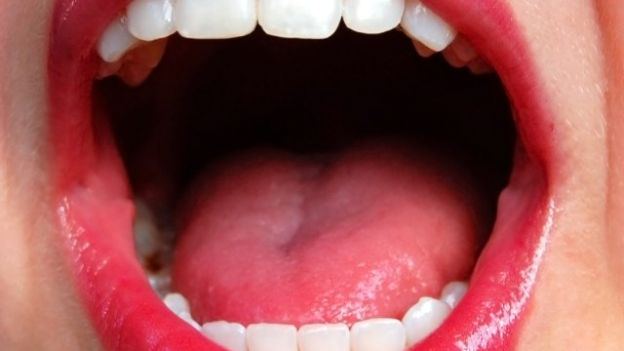 A VOLTE VI BRUCIANO LE LABBRA O AVETE PIZZICORE ALLA LINGUA? POTRESTE AVERE QUESTA SINDROME - 30/08/2015