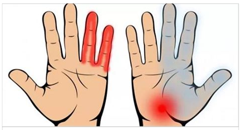FORMICOLII E DOLORI ALLE MANI? POSSONO ESSERE SINTOMI DI PROBLEMI ANCHE GRAVI: NON TRASCURATE I SEGNALI DEL VOSTRO CORPO - 21/06/2017