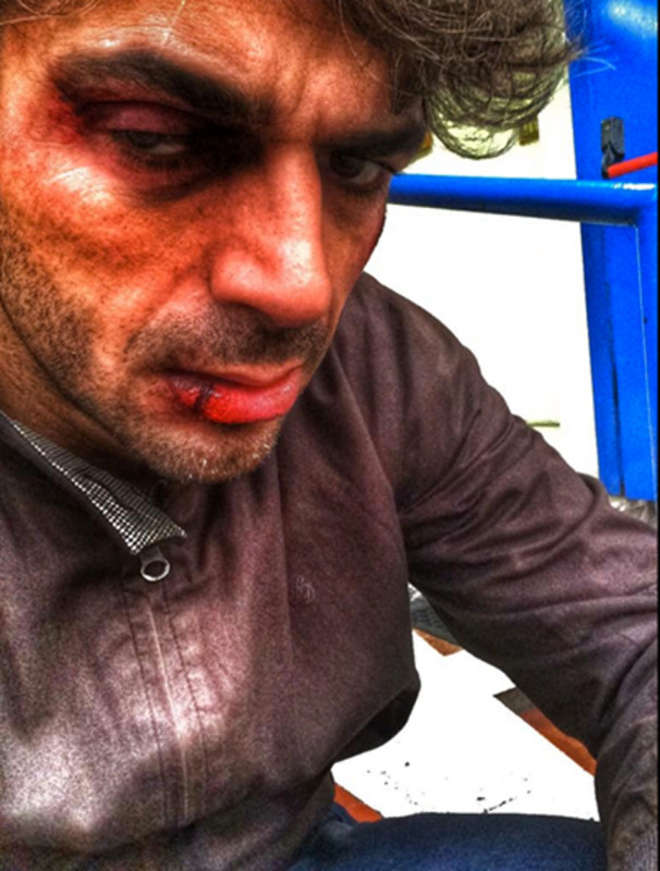 LUCA ARGENTERO: OCCHI NERI, LABBRA SPACCATE E VOLTO TUMEFATTO SU FACEBOOK - 22/10/2014