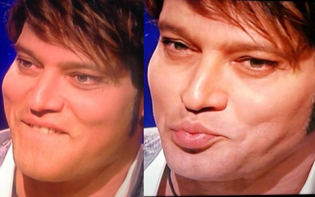 GABRIEL GARKO SVELA IL SUO DRAMMA: NESSUN BOTULINO, SONO AFFETTO DA UNA MALATTIA'' - 07/05/2015