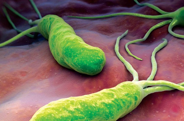 L'HELICOBACTER PYLORI PUO' ESSERE DEVASTANTE, MA IN POCHI SANNO DI AVERLO IN CORPO - 12/05/2015