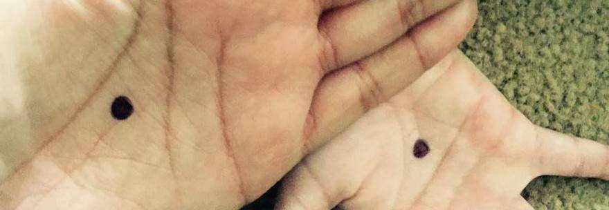 UN PUNTINO NERO SUL PALMO DELLA MANO, LE FOTO INVADONO I SOCIAL: ECCO IL MOTIVO - 21/09/2015