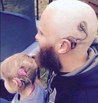 SI TATUA UN IMPIANTO COCLEARE TALE E QUALE A QUELLO DELLA FIGLIA NON UDENTE - 20/03/2016