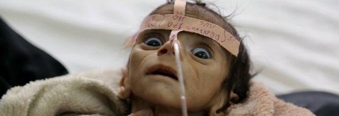 LA STORIA DIETRO LA FOTO DEL BAMBINO DI 5 MESI CHE HA SCONVOLTO IL MONDO: ''NON HA PIANTO'' - 30/03/2016