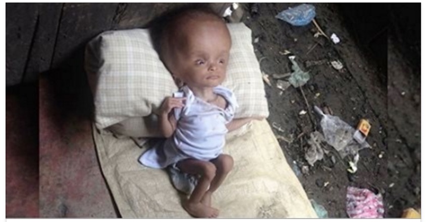 TROVA UNA NEONATA NELLA SPAZZATURA: DOPO 2 ANNI LA SUA TRASFORMAZIONE E' INCREDIBILE - 03/04/2016