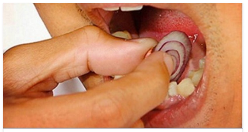 ECCO CHE COSA ACCADE SE METTIAMO LA CIPOLLA SU UN DENTE - 10/04/2016