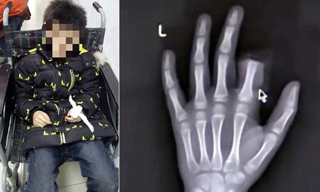 I GENITORI: ''USI TROPPO LO SMARTPHONE''. E LUI A 11 ANNI REAGISCE COSI' - 10/03/2016
