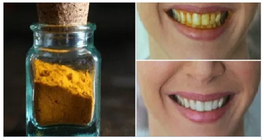 ECCO COME SBIANCARE I DENTI IN 3 MINUTI USANDO LA CURCUMA - 13/03/2016