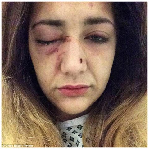 MASSACRATA DI BOTTE DAL FIDANZATO: AGGREDITA L'EX CONCORRENTE DI X FACTOR - 24/03/2016