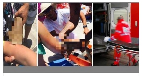 CORSA IN OSPEDALE URLANDO DAL DOLORE: ''STACCATELO! STACCATELO!'' - 16/05/2016