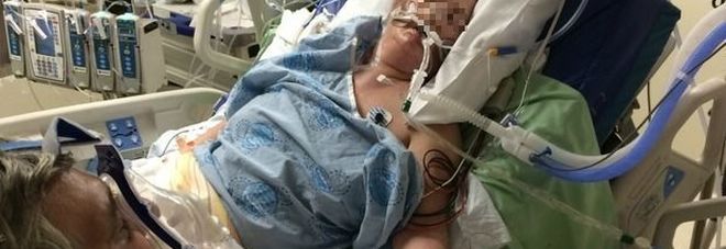 ''QUESTI SONO I MIEI GENITORI: MANO NELLA MANO IN UNA CAMERA DELL'OSPEDALE'' - FOTO - 21/05/2016