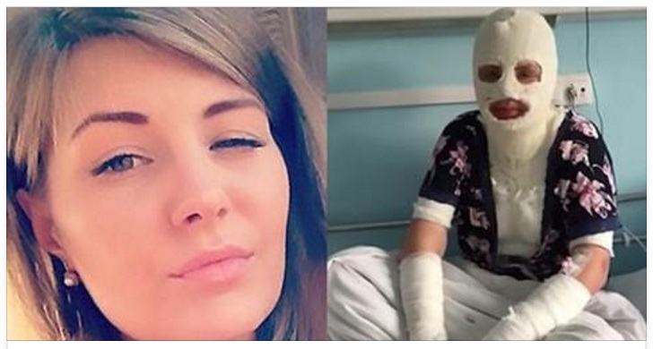 BRUCIATA DAL RAGAZZO: ''HO PROVATO A TOGLIERMI LA MAGLIETTA, LUI ME LO HA IMPEDITO... - 26/03/2017