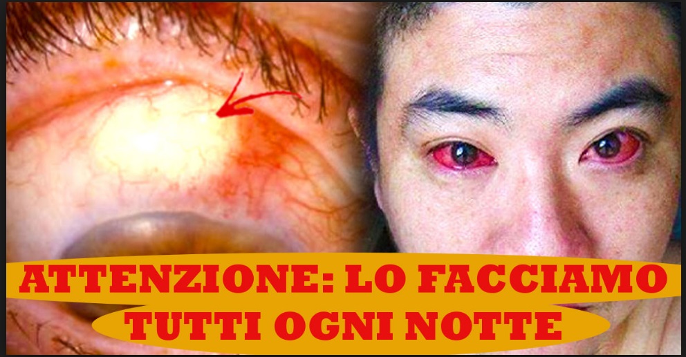 SCOPRE DI AVERE UN CANCRO AGLI OCCHI: QUAL'E' STATA LA CAUSA? ECCO COSA FACEVA OGNI NOTTE - 26/03/2017