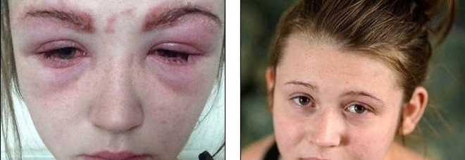 SI FA TINGERE LE SOPRACCIGLIA DA UN'AMICA E RISCHIA DI RIMANERE CIECA - 21/10/2014