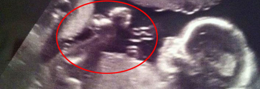 LA GIOVANE MAMMA RIGUARDA LA SUA ECOGRAFIA DOPO 2 ANNI. E FA UN'INCREDIBILE SCOPERTA - 23/01/2016
