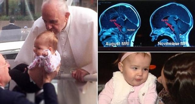 PAPA FRANCESCO, IL MIRACOLO E AVVENUTO: LA BIMBA CHE HA BACIATO E' GUARITA UFFICIALMENTE - 03/02/2016