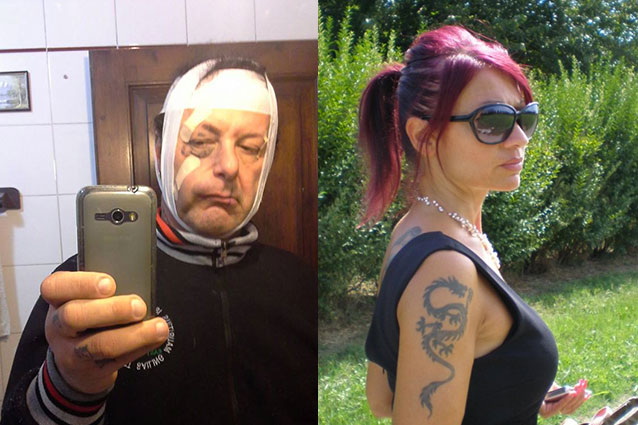 FEROCEMENTE PICCHIATO: L'ATTORE POSTA SU FACEBOOK QUESTO SCATTO - ECCO COS'E' ACCADUTO - 13/02/2016
