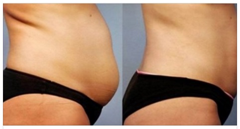 ACCELERA IL METABOLISMO E AIUTA A TORNARE IN FORMA: BASTA FARLO PER 5 SECONDI - 05/03/2016