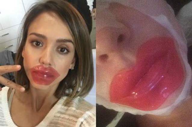 E' LA NUOVA MANIA CHE SPOPOLA TRA LE DONNE: SI APPLICA SULLE LABBRA PER 15 MINUTI ED ECCO COSA ACCADE - 26/01/2016