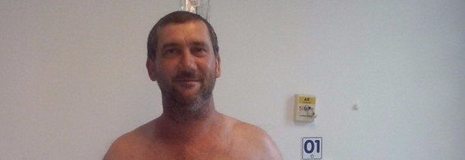 SI SVEGLIA DALL'OPERAZIONE CON LA MANO DENTRO LA SUA PANCIA: ECCO LA SPIEGAZIONE DEI MEDICI - 04/04/2016