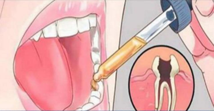 IL RIMEDIO CONTRO IL MAL DI DENTI CHE I DENTISTI NON TI DICONO, ECCO COSA DOVETE SAPERE - 26/07/2016
