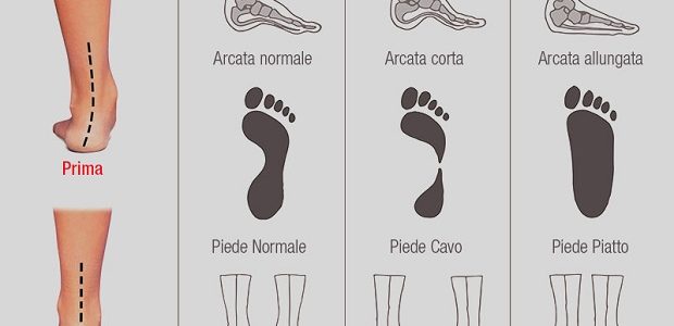 DOVE SI CONSUMANO LE VOSTRE SCARPE? ECCO COME INDIVIDUARE LE ABITUDINI CHE DANNEGGIANO LA SALUTE - 19/10/2016