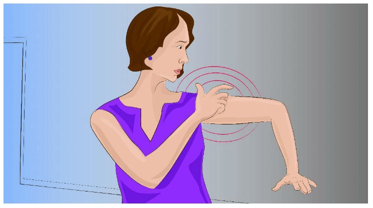 8 SINTOMI DELL'ICTUS A CUI LE DONNE DOVREBBERO PRESTARE PARTICOLARE ATTENZIONE - 02/04/2017