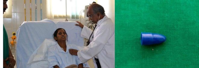 PER 10 ANNI HA UNA FORTE TOSSE PUZZOLENTE: LA SCOPERTA CHOC DEI MEDICI - 02/04/2017