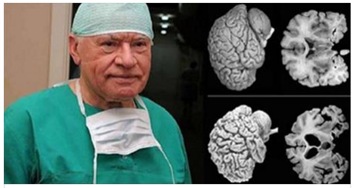 I NEUROSCIENZIATI HANNO DATO L'ALLARME: DONNE PRESTATE MOLTA ATTENZIONE A QUESTO CONSIGLIO... - 03/04/2017