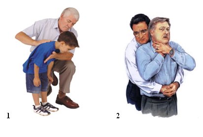 COME SALVARE UN BAMBINO DAL SOFFOCAMENTO: IL VIDEO-TUTORIAL MOSTRA COME SI FA - GUARDA - 14/06/2014