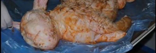 L'AGNELLINO NASCE CON UN ''VOLTO UMANO'': ''TROPPA VITAMINA A NEL MANGIME'' - FOTO - 14/05/2014