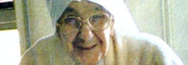 SUOR GIUSEPPINA E LA SCRITTA 'MARIA' SUL BRACCIO. IL MEDICO: 'NON HO MAI VISTO NULLA DEL GENERE' - 16/05/2014