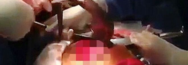 ESTRAGGONO UN'ANGUILLA VIVA DAL SUO ADDOME, LUI CONFESSA: ''ECCO COME CI E' FINITA'' - 06/11/2014