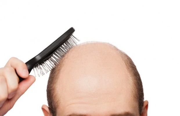 CALVIZIE: CURA RIVOLUZIONARIA PER FAR RICRESCERE I CAPELLI ALL'IDI DI ROMA - 29/01/2015