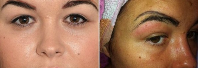 VA DALL'ESTETISTA PER DELLE SOPRACCIGLIA NUOVE, L'EFFETTO È TERRIBILE: ''VORREI NON AVERLO FATTO'' - 08/03/2015