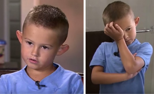 SOFFRE PERCHE' HA LE ORECCHIE A SVENTOLA, ECCO COSA FANNO I GENITORI - 03/10/2015